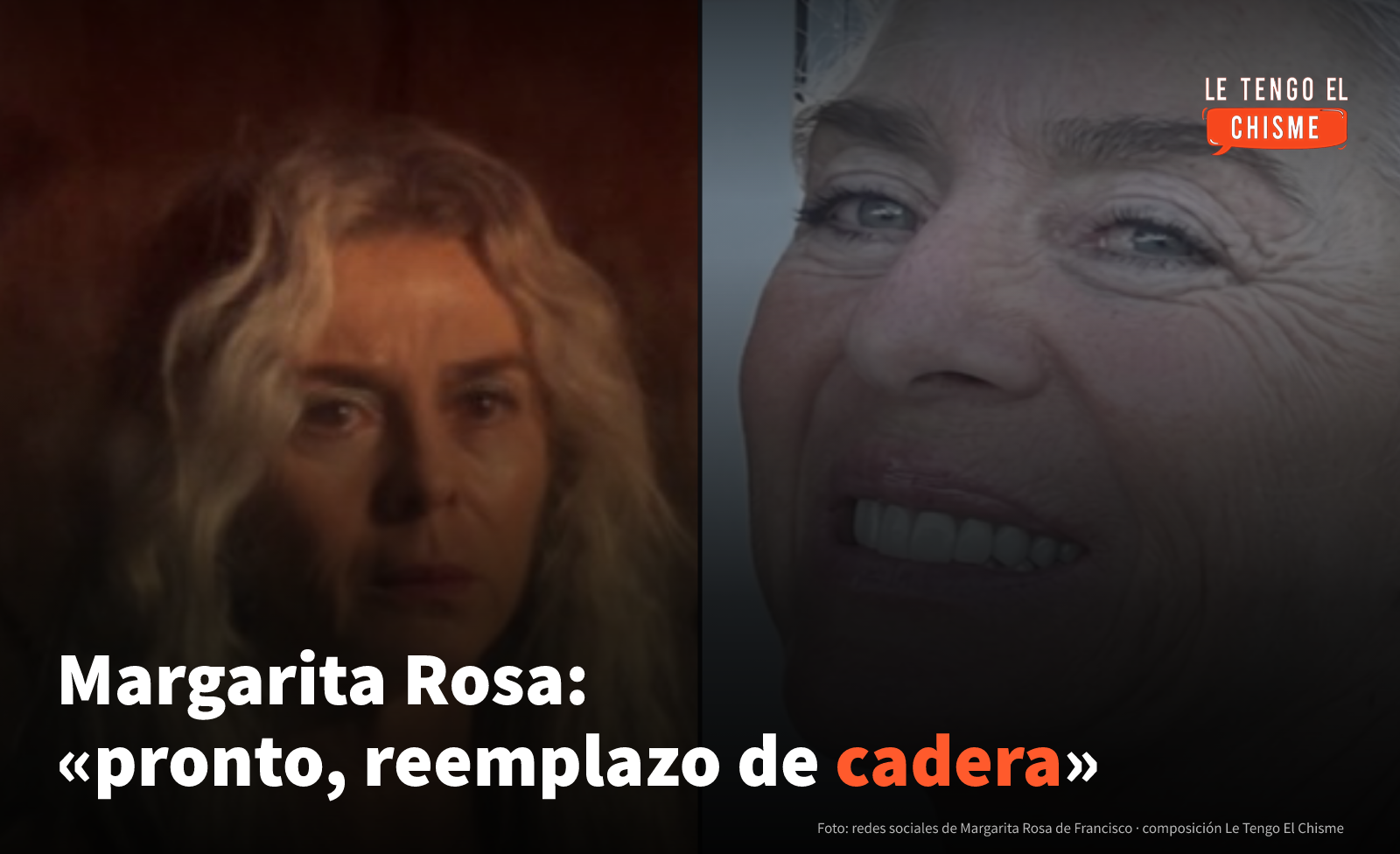 «Pronto, reemplazo de cadera»: Margarita Rosa de Francisco confirmó que se acerca su cirugía